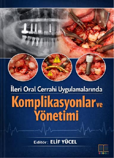 İleri Oral Cerrahi Uygulamalarında Komplikasyonlar ve Yönetimi kapak görseli