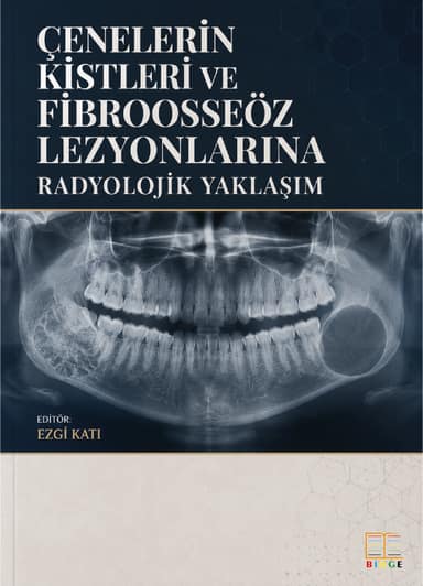 Çenelerin Kistleri ve Fibroosseöz Lezyonlarına Radyolojik Yaklaşım kapak görseli
