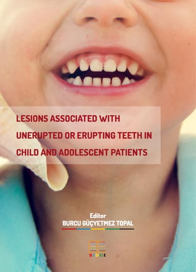 Lesions Associated with Unerupted Or Erupting Teeth in Child and Adolescent Patients kapak görseli