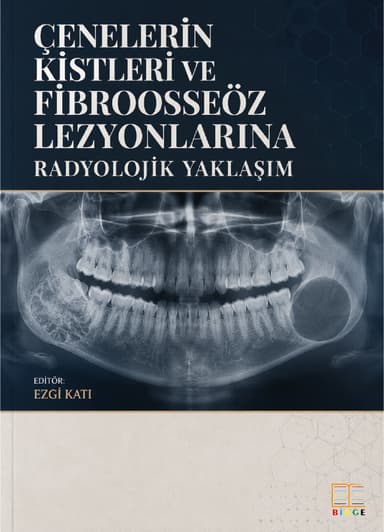 Çenelerin Kistleri ve Fibroosseöz Lezyonlarına Radyolojik Yaklaşım kapak görseli